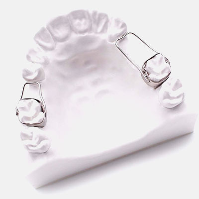 Ортодонтические кольца